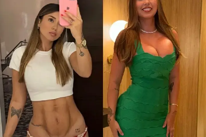 Influenciadora denuncia clínica após ter “corpo deformado” – VEJA FOTOS