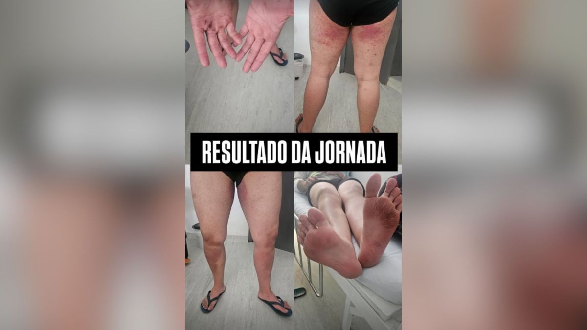 Irmã de jovem desaparecido em trilha posta foto de lesões do irmão; veja