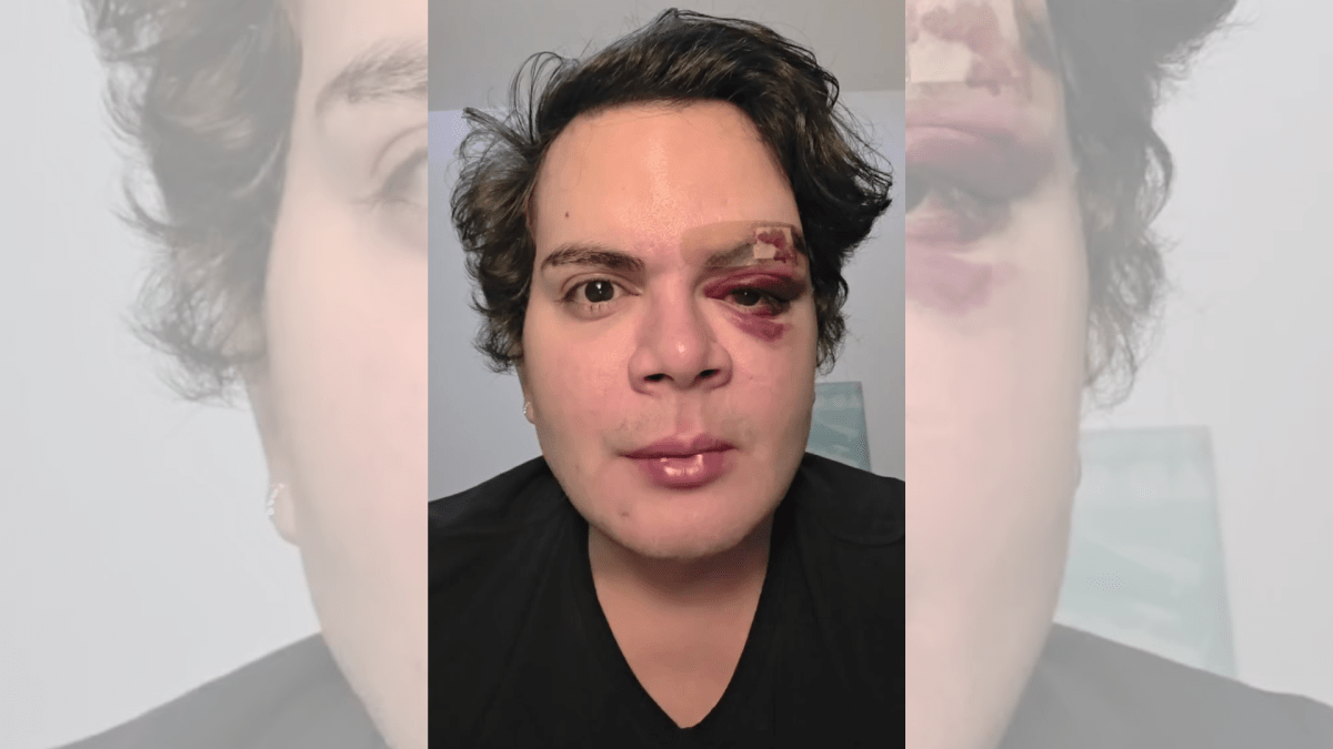 Médico denuncia agressão e homofobia no próprio apartamento no Recife
