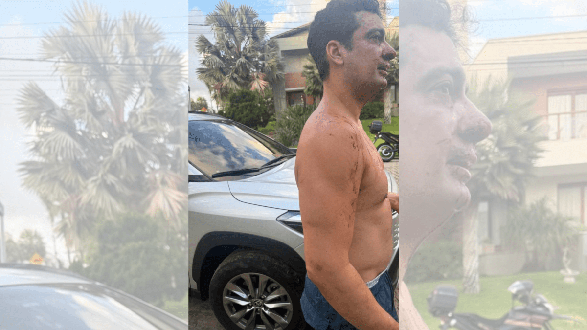 Morador denúncia agressão por atleta do Fortaleza em condomínio de luxo