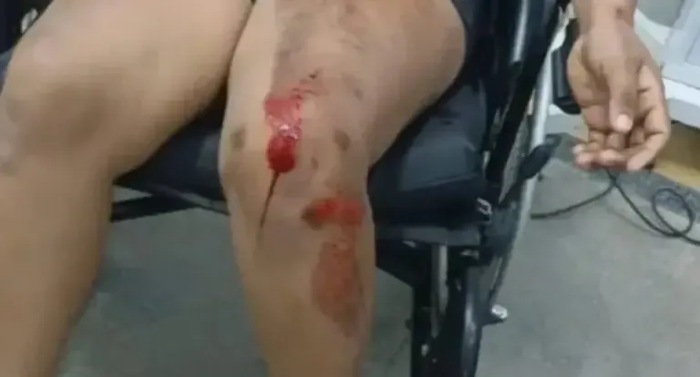 Mulher é socorrida após tentativa de automutilação em residência em RO