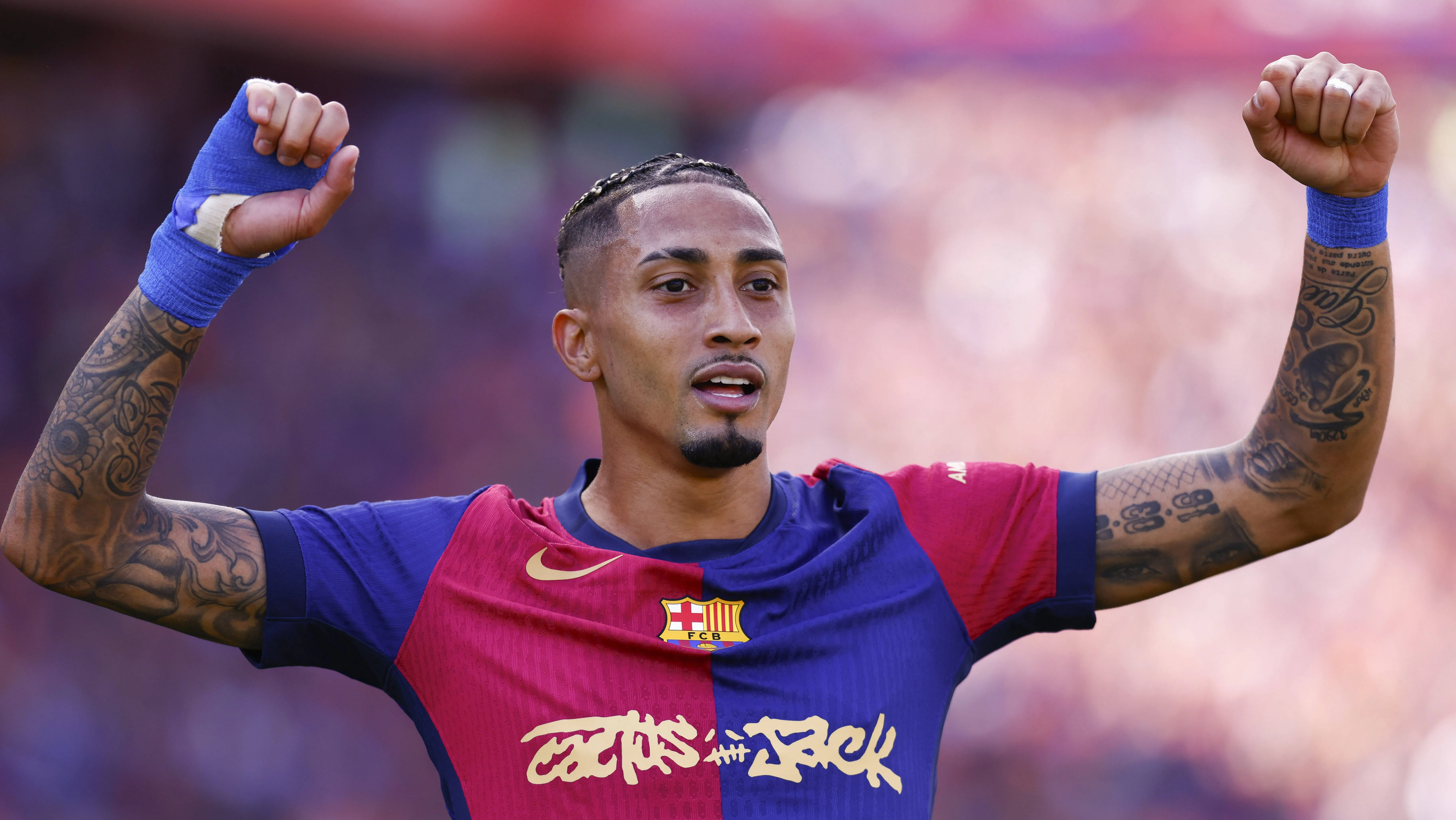 Por que jogadores do Barcelona usam bandagens nas mãos